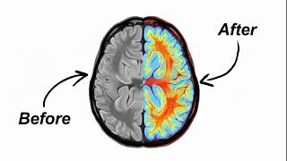 Unf*ck your brain with this playlist - you need to focus.