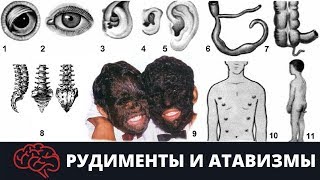 Рудименты и атавизмы. Подготовка к ЕГЭ