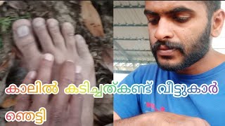 Daily vlog-14  എന്റ കാലിൽ എന്തോ കടിച്ചു guys 😱😱Something bit my leg guys 😱😱