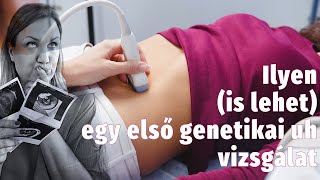 Első GENETIKAI ultrahang- részletesen a rendelőből