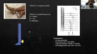 Introduc. monitoreo electrofisiológico normal y patológico en CTI. Periférico. Dr. Hackembruch