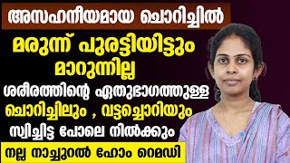 ശരീരത്തിന്റെ ഏതു ഭാഗത്തുള്ള ചൊറിച്ചിലും വട്ടച്ചൊറിയും പെട്ടെന്ന് മാറാൻ നല്ല നാച്ചുറൽ ഹോം റെമഡി