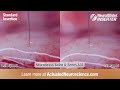 NeuralGlider NeuroNexus Acute A Series A32 Comparison