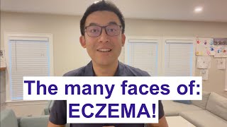 The many faces of Eczema!