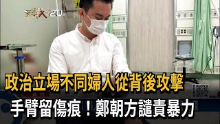 政治立場不同婦人從背後攻擊　手臂留傷痕！鄭朝方譴責暴力－民視新聞