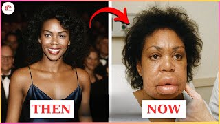 19 Black Actors Who Look Horrible With Plastic Surgery | Then and Now 2025