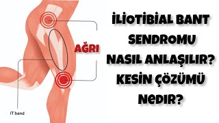 DİZ AĞRISININ SEBEBİ İLİOTİBAL BANT SENDROMU OLABİLİR | Fizyoterapistten Ağrı Bitirici Egzersizler