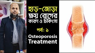 হাড়-জোড়া ক্ষয় রোগের কারণ ও চিকিৎসা | BONE \u0026 JOIT DISEASE TREATMENT