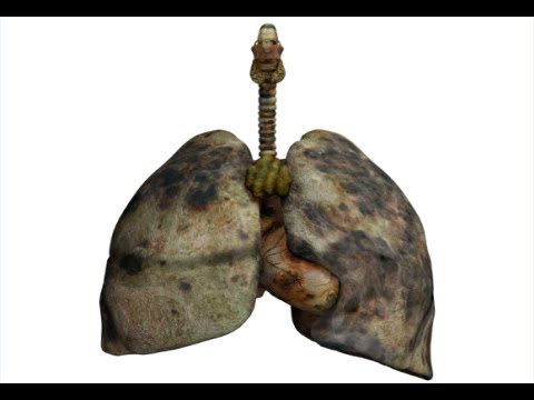 How to Detox Smokers Lungs - Lung Cleanse For Smokers How to Detox Smokers Lungs - Lung Cleanse For Smokers