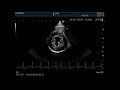 right parasternal short axis view by echocardiography in normal dogs and cats（正常な犬猫の心エコー右傍胸骨短軸像）