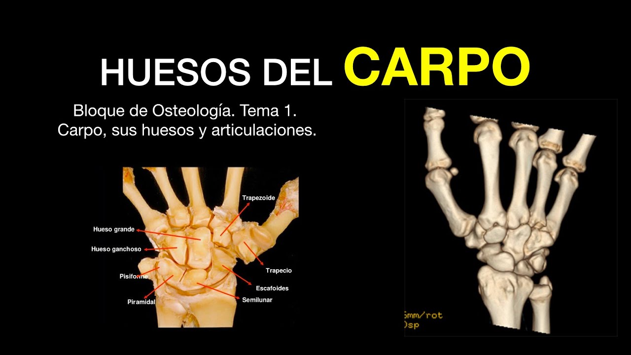 Huesos Del Carpo