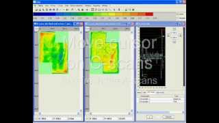 ULTIS - Processing A-scans