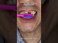 ASMR Trolls World Toothbrush: A Fun & Relaxing Way to Brush Your Teeth #DoctorTristanPeh see more👆