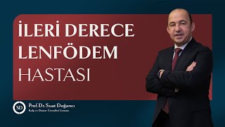 İleri Derece Lenfödem Hastası