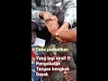 pengobatan tulang bengkok virral ‼️pengobatan tulang bengkok dayak