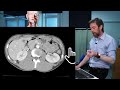 Abdomen transverse CT imaging anatomy