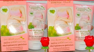 স্ট্রেচ মার্ক রিমুভাল ক্রিমের দাম জানুন/Strech Mark Cream Repair Cream Price.