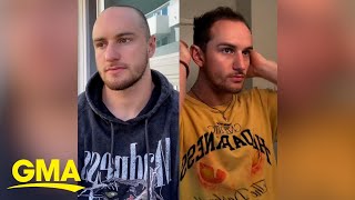 TikTok influencer who started losing hair at 19 breaks stigma around male hair loss l GMA