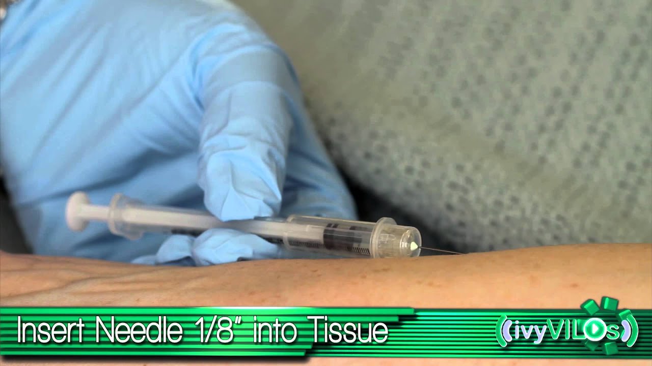 Bleb Intradermal Injection