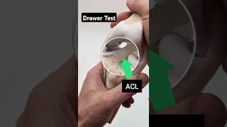 Demonstrating the Anterior Drawer Test with the Dynamic Knee Model #acl #knee