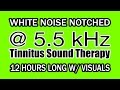 White Noise - Notch Filtered at 5.5 kHz for Tinnitus Therapy w/ Visuals