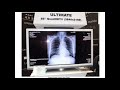 Digital radiography system