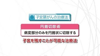 【知りたい！がん検診】Vol.454回「子宮頸がんの治療」