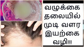 முன் நெற்றியில் 100% முடி வளர இந்த ஒரு வழி போதும் //mylittleworld tamil