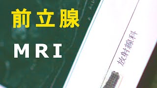 前立腺 MRI 診断をしてきた