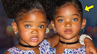 Ken Je De Mooiste Zwarte Tweeling Ter Wereld Nog? Dit Is Wat Er Met Hen Gebeurde!