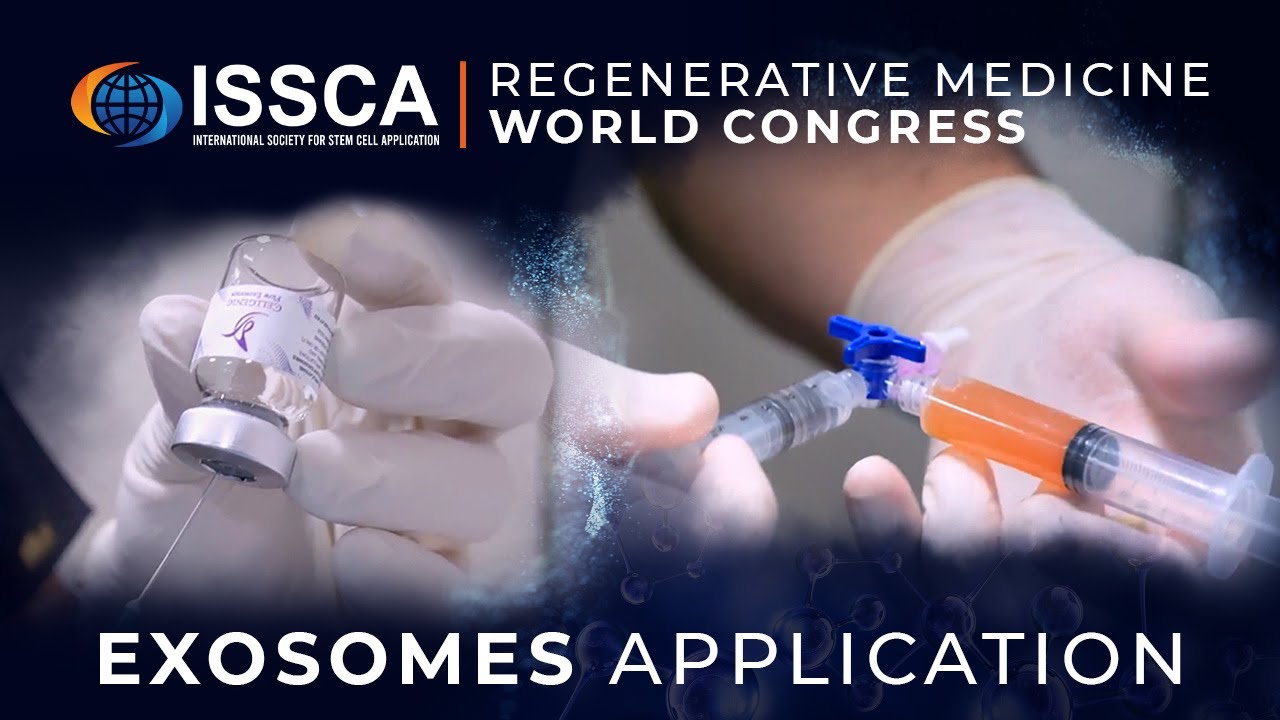 Exosomes Application â Issca Regenerative Medicine World Congress Youtube