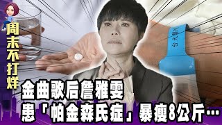 金曲歌后詹雅雯患「帕金森氏症」暴瘦8公斤...拒絕腦部手術！-【阿娟周末不打烊】獨播