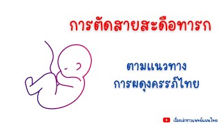 การตัดสายสะดือทารกตามแนวทางการผดุงครรภ์ไทย #การตัดสายสะดือทารก #ผดุงครรภ์ไทย #แพทย์แผนไทย