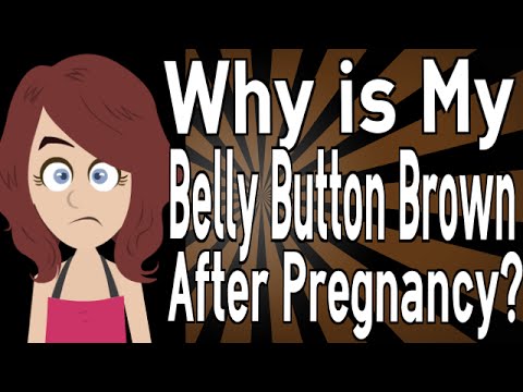 Why is My Belly Button Brown After Pregnancy? Why is My Belly Button Brown After Pregnancy?