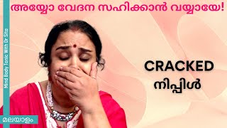 അയ്യോ വേദന സഹിക്കാൻ വയ്യായേ | Cracked നിപ്പിൾ  |എന്തുകൊണ്ട് | നാച്ചുറൽ ആയി പരിഹാരം | Dr Sita