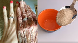 Make Your Hands Look 10 Years Younger / Remove Wrinkles on Hands / Skin Care / Botox at Home