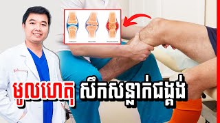 ជំងឺសឹកសន្លាក់ជង្គង់ ,  Osteoarthritis of the knee