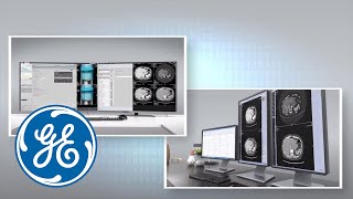 GSI Xtream Workflow Makes Spectral CT Routine | GE Healthcare