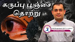 What is Black Fungus (கருப்பு பூஞ்சை) Symptoms | Precautions | Treatment |