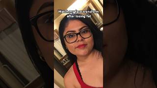 Face fat loss transformation !!! / weight loss / #fatloss #weightloss #weightlosstransformation