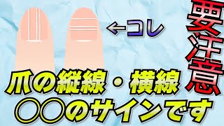 【意外と知らない】爪に縦線・横線がでる原因【健康 雑学】