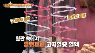 고지혈증의 충격 실험! [내 몸 플러스] 20회 20160821