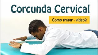 Adeus Corcunda! - Como tratar a corcunda cervical? - Melhore a Postura – PARTE 2