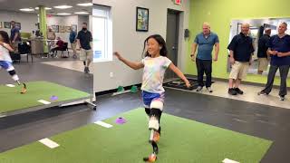 Spring Break at POA - New prosthetic legs for these growing kids
