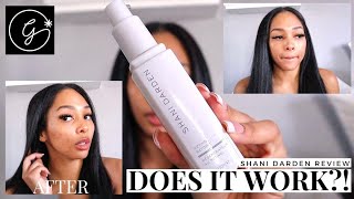 SHANI DARDEN RETINOL REFORM REVIEW + BEFORE \u0026 AFTER 14 DAYS!!! 😳