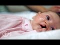 Explaining Cleft Lip and Palate (1 of 7)