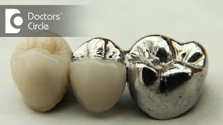 Comparison between Ceramic, Porcelain and  metal crowns - Dr. Aniruddha KB