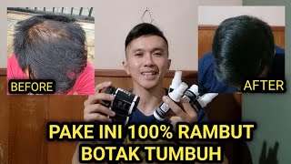 CARA MENUMBUHKAN RAMBUT BOTAK DAN RONTOK SUPER AMPUH. MINOXIDIL PLUS FINASTERIDE PLUS BIOTIN ZINC.