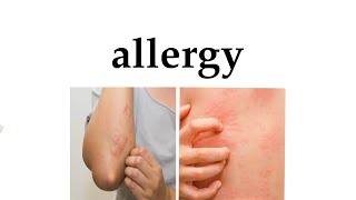 #oral_surgery allergy طب الأسنان مرحلة رابعة