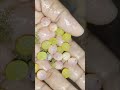 catfish eggs ഈ മീൻമുട്ടകൾ വിരിയില്ല 😢 fishing catfish keralafishing castnetfishing catfisheggs